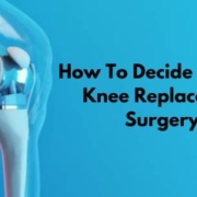 How To Decide Time For Knee Replacement Surgery