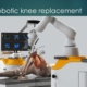 Best Hospital for Robotic Knee Replacement Surgery in Delhi
