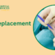 Elbow Replacement Surgery by Dr. Raj Kumar