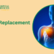 Shoulder replacement surgery in Ayushman Hospital