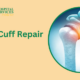 Rotator Cuff Repair Surgery in Dwarka